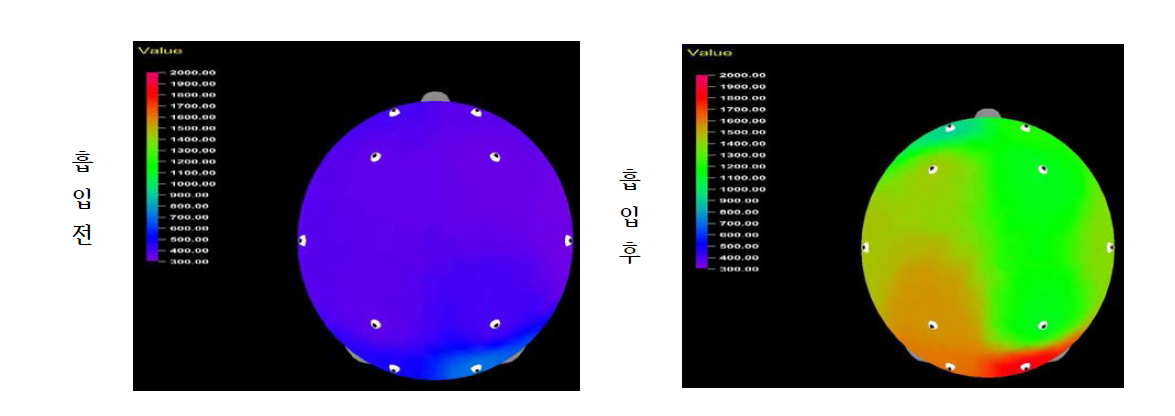 감국의 휘발성 성분 흡입 전과 후에 따른 피실험자의 쎄타파 변화