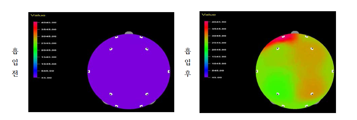 감국의 휘발성 성분 흡입 전과 후에 따른 피실험자의 감마파 변화