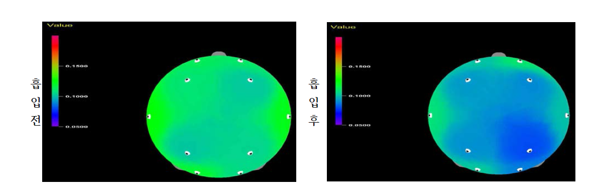 감국의 휘발성 성분 흡입 전과 후에 따른 피실험자의 감마파 상대비율 변화