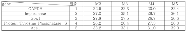 Real time PCR of M1, M2 and M3