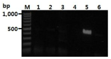 양파에 발생하는 곰팡이병에 대한 노균병균 검출용 PCR법의 비특이적 반응 검정 (M : 100 bp DNA ladder, 1: 잎마름병균 Stemphylium sp., 2: 잿빛곰팡이병균 Botrytiscinerea, 3: 탄저병균Colletotrichum gloeosporioides, 4: 노균병균 Pseudoperonosporacubensis, 5: 양파 노균병균 Peronospora destructor 6: 음성대조구)
