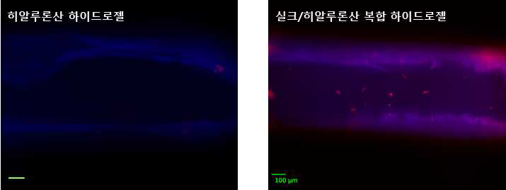 하이드로젤 표면에 섬유아세포 배양 14일 후 하이드로젤 단면의 형광현미경 이미지