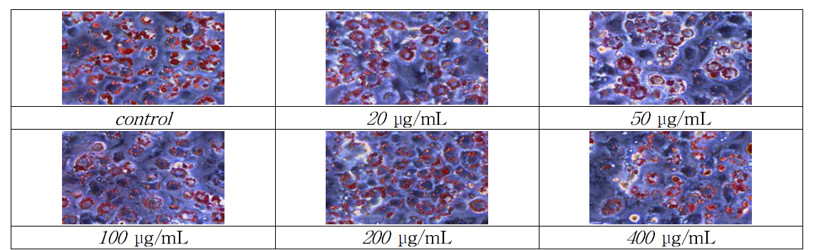 Representative images of Oil Red O staining in 60℃ water extract of blue honeysuckle