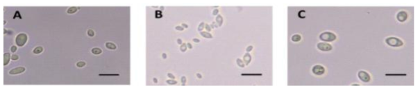 Cell morphologies of yeasts isolated from natural fermentation of apple. Bar indicates 10 μm. A; Pichia anomala GC1-4, B; Hanseniaspora uvarum CS3-31, C; Saccharomyces cerevisiae CS9-30