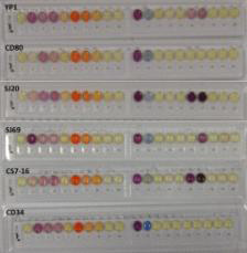 The results of enzymatic activities of six types of selected yeasts by API ZYM kit