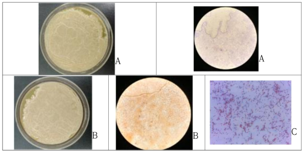 Microscope photographs of Bacillus spore cultivated at 37℃ for 7days. A; B. subtilis HJ0-6 cultivated on BHI agar medium. B: B. amyloliquefaciens HJ5-2 cultivated on BHI agr medium. C; B. subtillis HJ0-6 cultivated on BHI broth medium