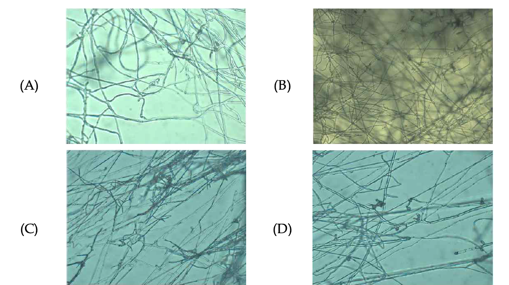 Pf185(A,B), Pf212(C,D) 균주의 탄저병원균에 대한 기생활성(X400) 왼편 : Pf185, Pf212, 오른편 : 고추 탄저병원균