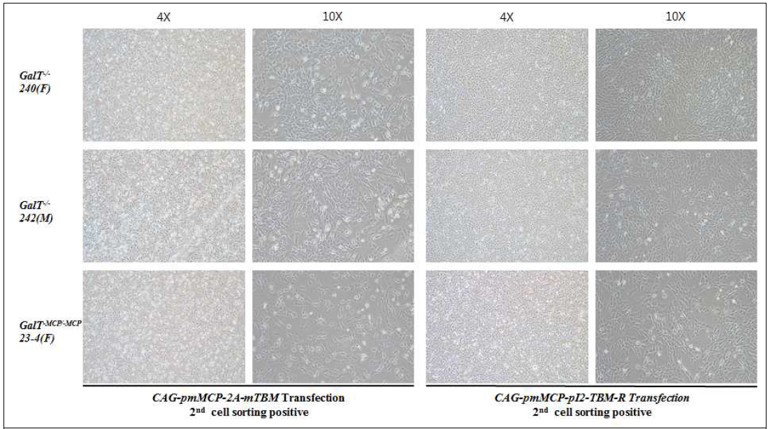 두 번의 cell sorting 후 세포의 형태학적 비교 분석