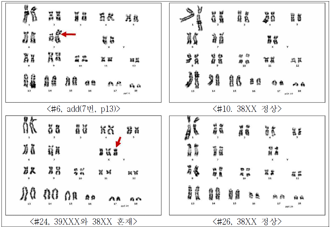 GalT-MCP/-MCP/MCP/TBM 형질전환 세포주의 염색체 분석 4종의 단일 클론의 세포 주(숫자로 표시)의 염색체 이상 유·무 분석. 화살표는 비정상 염색체를 의미