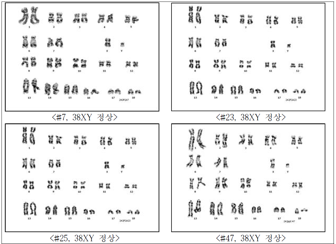 GalT-/-/MCP/TBM 형질전환 세포주의 염색체 분석 4종의 단일 클론의 세포 주(숫자로 표시)의 염색체 이상 유·무 분석