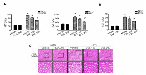 EUL extract protect against HFD-induced hepatic functional damage. (A) AST, ALT, and GGT (B) were measured in HFD-treated rats. (B) H&E) staining assays was performed using the liver (100x magnification). Values are means ± SD. (n = 6, *P < 0.05 vs. NCD-group, **P < 0.05 vs. HFD-group)