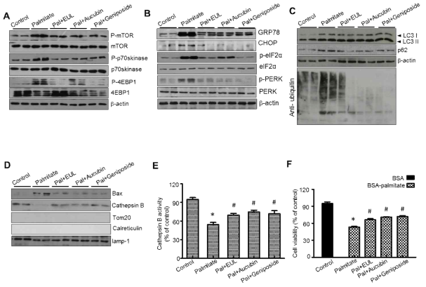 Effects of EUL on ER stress and lysosomal function in HepG2 cells. (A) HepG2 cells were treated the indicated concentrations of 50 μg/ml, 100 μg/ml, and 250 μg/ml EUL for 24 h for indicated periods, and protein level was etermined using the western blotting assay. (A–C) Representative western blots with the indicated antibodies. (D) HepG2 cells were incubated with the indicated concentrations of EUL extract for 24 h, and cathepsin B activity was determined. (E) HepG2 cells were treated with the indicated concentrations of 50 μg/ml, 100 μg/ml, and 250 μg/ml EUL for 24 h for indicated periods, and cytotoxicity was determined using the MTT assay. Values are means ± SD. n = 3, *P < 0.05 vs. control, #P < 0.05 vs. palmitate-treated