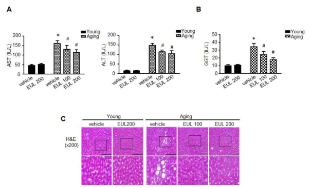 EUL extract protect against aging-induced hepatic functional damage. (A) AST, ALT, and GGT (B) were measured in aging rats. (B) H&E) staining assays was performed using the liver (100x magnification). Values are means ± SD. (n = 6, *P < 0.05 vs. Young-group, **P < 0.05 vs. aging-group)