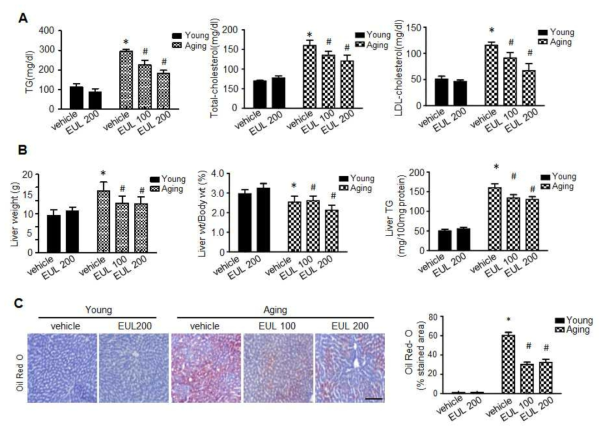 EUL prevents aging-induced hepatic steatosis. Rats were given a young rat or an aging rat with or without 100mg/kg and 200mg/kg EUL extract for 6 wk, and serum and liver were harvested. (A). Biochemical analysis of serum samples. Levels of TG, TC and LDL-c were measured in the serum of rat in different experimental groups. (C) Liver weight, and (D) Liver weight/Body weight and (E) liver TG content were measured 6 wk after initial mulberry administration (n = 6).(E) Liver tissues retrieved 6 wk after initial EUL administration were subjected to Oil red O staining, Scale bars, 200 μm. Values are means ± SD. (n = 6, *P < 0.05 vs. Young-group, **P < 0.05 vs. aging-group)