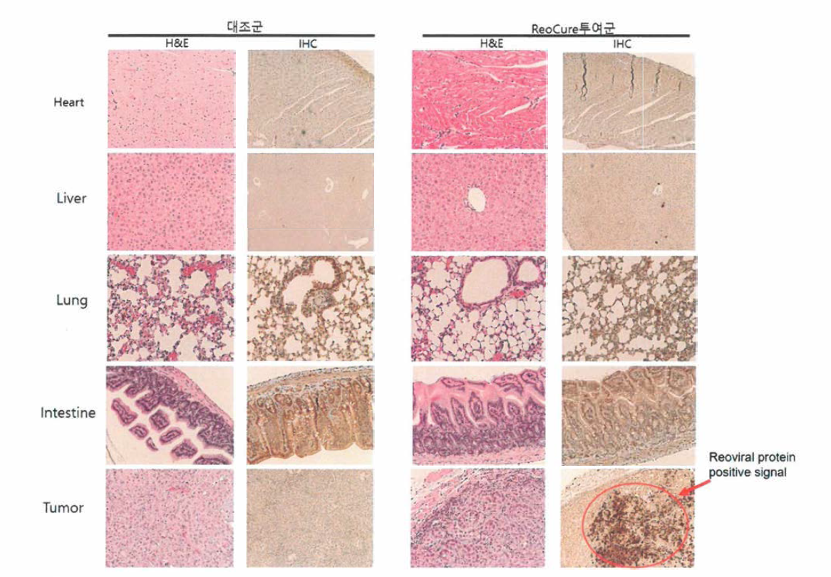 Figure. H&E and IHC study of reovirus-treated mice (A549 human lung tumor xenografts grown subcutaneously in nude mice). Nude mice를 사용하여 A549 cell을 티하에 투여하여 종양을 형성하고 리오바 이러스를 3회투여하고 34일간 종양의 볼륨의 비교함 (PBS； PBS투여군 n=8, Reovirus： Reovirus 투여군 n=8) 34 일째 Sacrifice 하여 각종장기 및 종양을 절개하여 고정한 후 H&E staining 및 IHC (Reoviral proteins) 염색후 사진을 찍음. 조직관찰결과 대조군과 투여군 각종 장기(뇌, 심장, 간, 폐. 장, 콩팥등)의 병리학적 특이사항은 없었으며 리오큐어를 투여한 종양에서 Reoviral proteins IHC 양성시그널을 관찰함