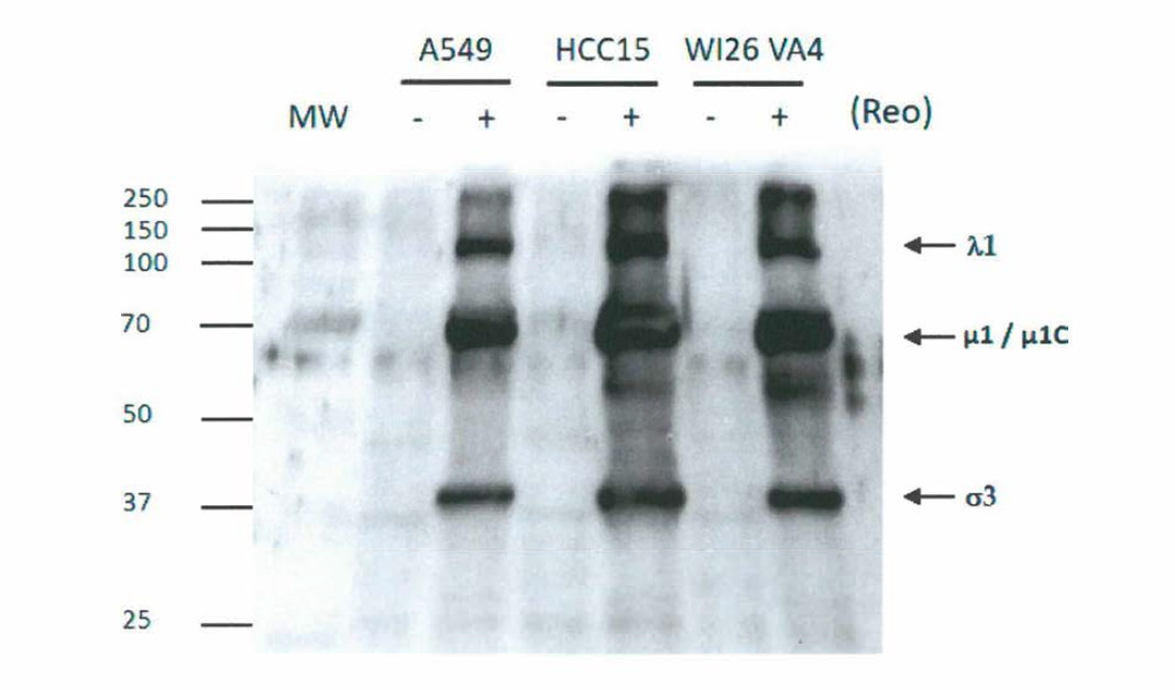 Western blot analysis of reoviral proteins in lung cancer cells. Various lung cancer cells (WI-26VA4, HCC-15, and A549) were challenged with Reovirus at MOI of 30. At 3days post-infection, cell lysates were examined by anti-reovirus antibody