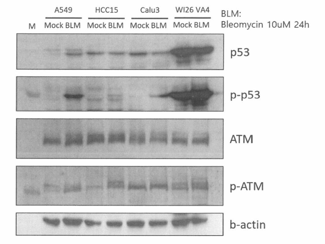 Tumor suppressor functions of lung cancer cells were evaluated by genotoxic treatment (Bleomycin). Cell lysates were examined with anti P53, phospho p53, ATM and p-ATM antibodies