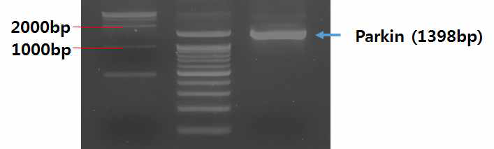 파킨슨병 유발 유전자(Parkin) PCR product 전기영동 결과