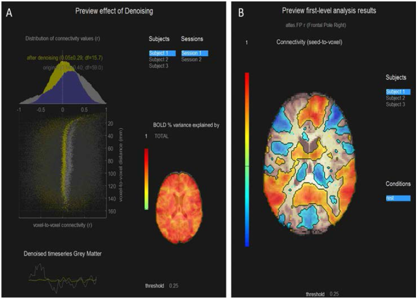 Resting state fMRI의 Denoising processing 결과(A)와 first level analysis 결과(B)