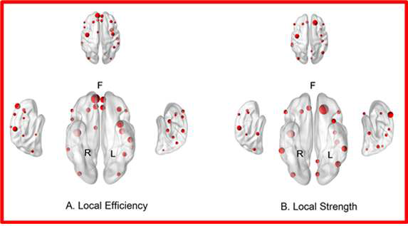 환자군에서 Local efficiency와 local strength의 값이 정량적 차이를 보인 뇌영역들