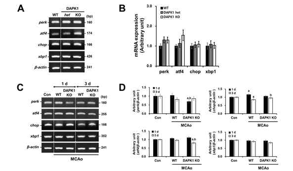 DAPK1 발현조절에 의한 소포체 스트레스 매개성 세포사멸 활성 억제 효과 확인