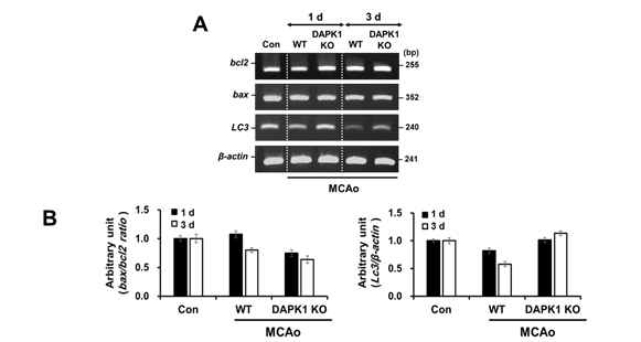 DAPK1 유전자 결손에 의한 신경세포사멸 반응기작 관련 유전자 발현변화