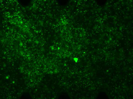 Fluorescent staining of bacteria in the device (green, SYTO9)