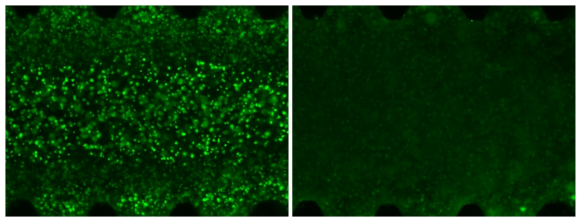 Comparison of images before/after the treatment of antibiotics