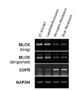 MLCK expression was decreased in Herceptin resistance HER2-positive BT474 breast cancer cell line