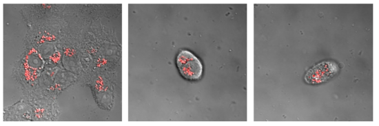 H292 sensitive lysosome detection with lyso-tracker