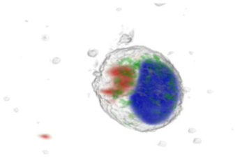 lysosome과 unidentified vesicle의 비교대조 이미지, Red = lysosome, Green = unidentified vesicle, Blue = Nucleus