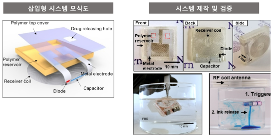 생분해성 무선제어 약물전달 시스템의 모식도 (좌) 및 실물 이미지 (우)