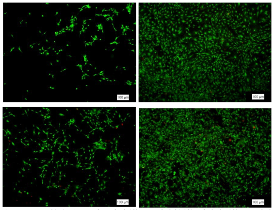 MC3T3-E1 growth with a) 0% nonpoled, b) 0% poled, c) 10% nonpoled, and d) 10% poled film conditions