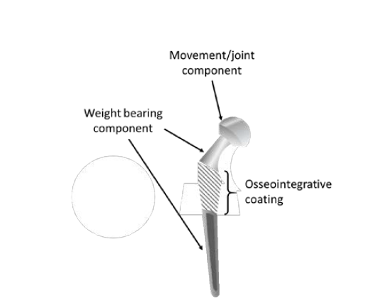 Diagram of a typical biomedical implant