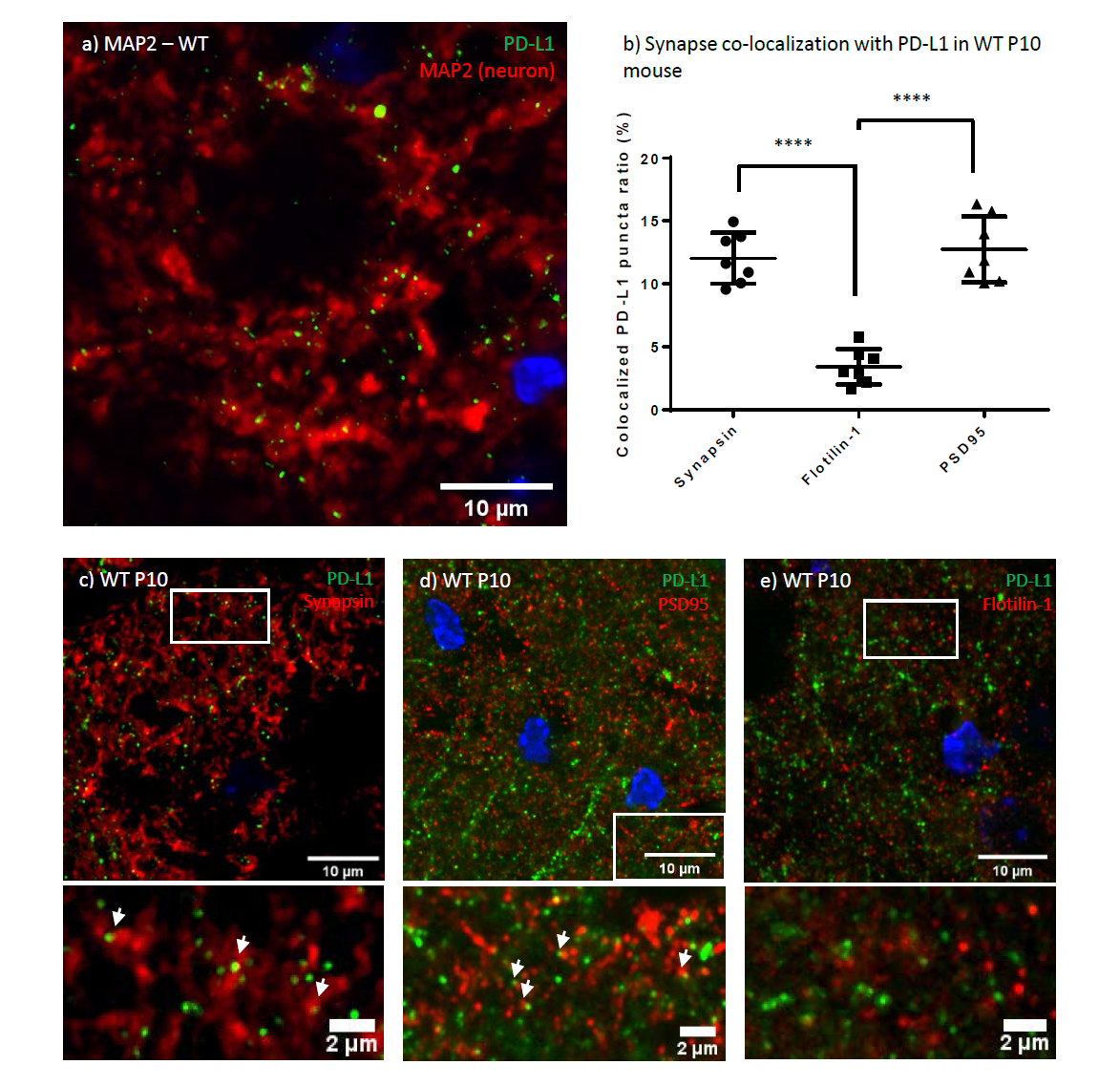 PD-L1 is expressed on the synapses of neurons