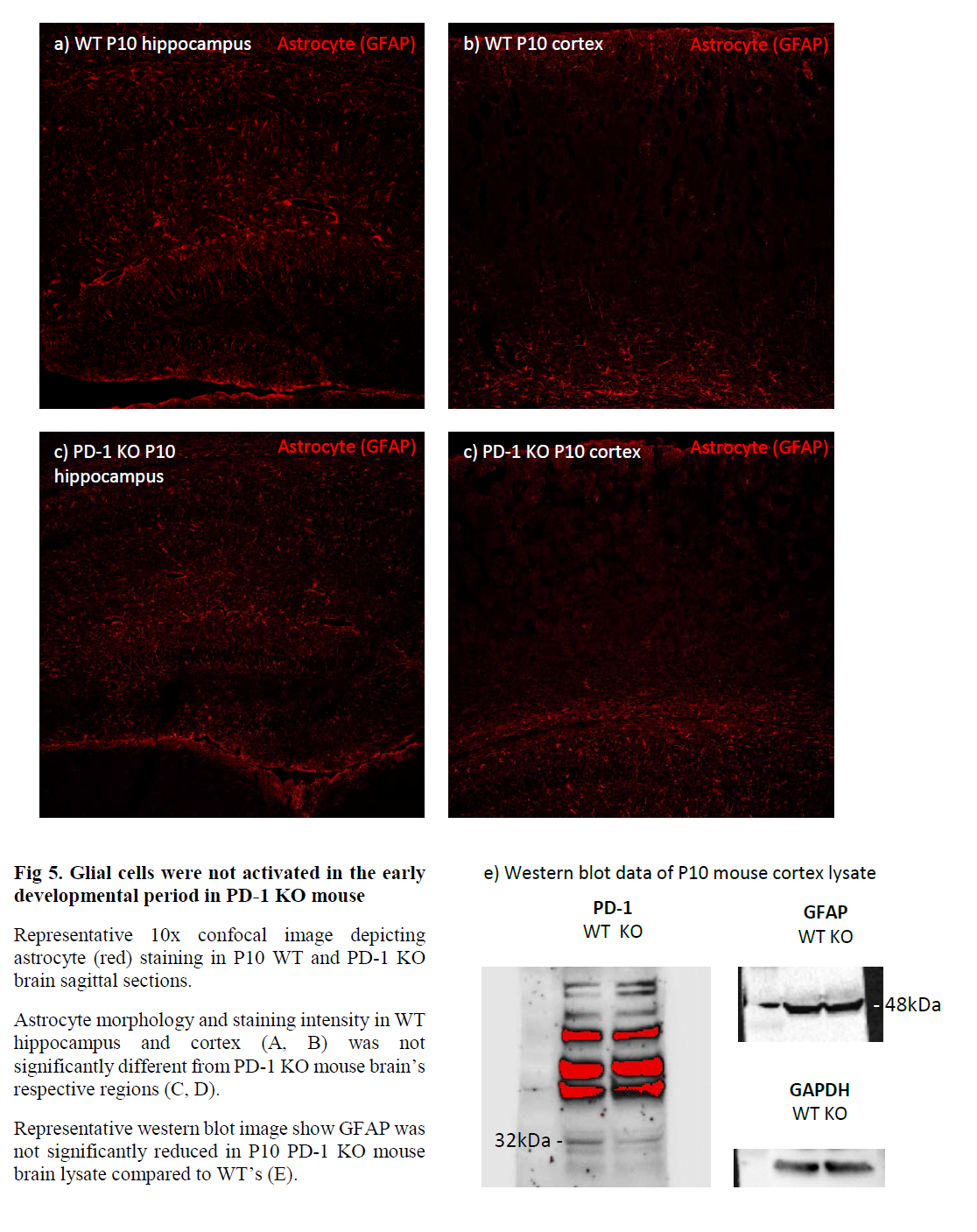 Glial cells were not activated in the early developmental period in PD-1 KO mouse