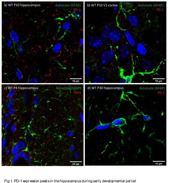 PD-1 expression peaks in the hippocampus during early developmental period