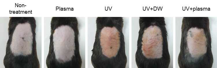 UV에 의해서 유도된 피부염증에 대한 액상플라즈마의 피부진정 효과