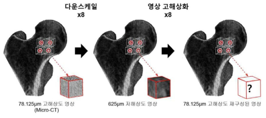 μ-CT 영상의 다운스케일링 및 고해상화 모듈을 사용한 골 미세구조 재구성의 과정