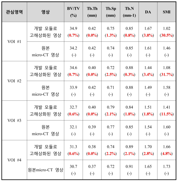 골격계 영상 고해상화 모듈의 검증 결과(해면골의 형태학적 지수)