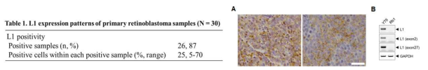 망막아세포종 환자조직에서 L1CAM의 발현 및 유형 분석