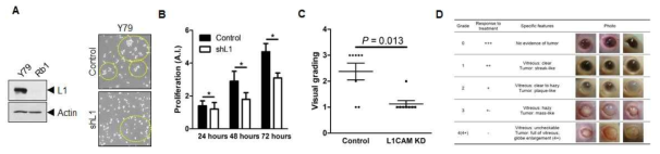 망막아세포종에서 L1CAM의 발현 조절을 통한 암의 성장 변화 분석