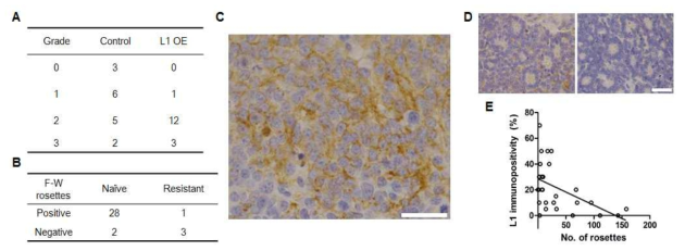 망막아세포종에서 L1CAM의 발현과 rosette 상관성 및 내성 연관성 분석