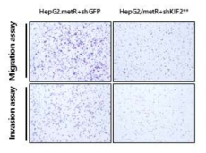 KIF2** 유전자 발현 억제 세포의 세포이동성 감소 현상