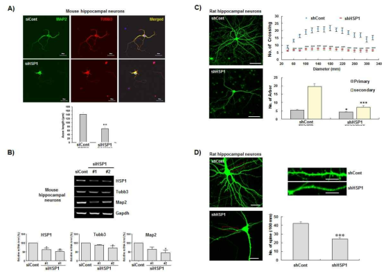 HSP1의 Knockdown시 Hippocampal neuron의 Axon의 길이 변화 확인