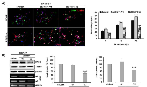 Human SHSY-5Y cell line의 HSP1의 저해에 의한 분화 능력 변화