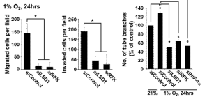 RFK 생합성 결핍과 저산소 유도 암세포 형질