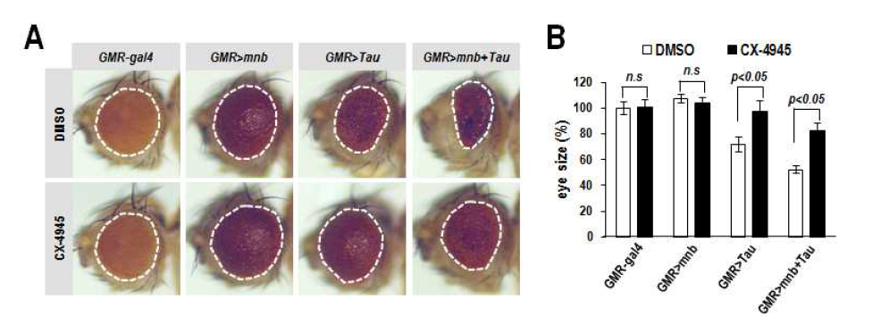 minibrain/Tau을 초파리 눈 특이적으로 과발현 했을 때 관찰되는 발달 결함 및 CX-4945에 의한 개선