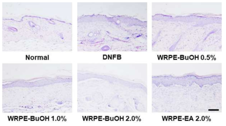 Histopathological findings in DNFB-induced chronic atopic dermatitis. H&E stain. WRPE-BuOH:butanol fraction of WRPE-MeOH extract, WRPE-EA: ethyl acetate fraction of WRPE-MeOH extract (scale bar = 100 μm)