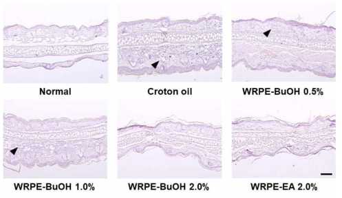 Histopathological findings in croton oil-induced contact dermatitis. Arrow head: acute inflammation. H&E stain. WRPE-BuOH: butanol fraction of WRPE-MeOH extract, WRPE-EA: ethyl acetate fraction of WRPE-MeOH extract (scale bar = 100 μm)